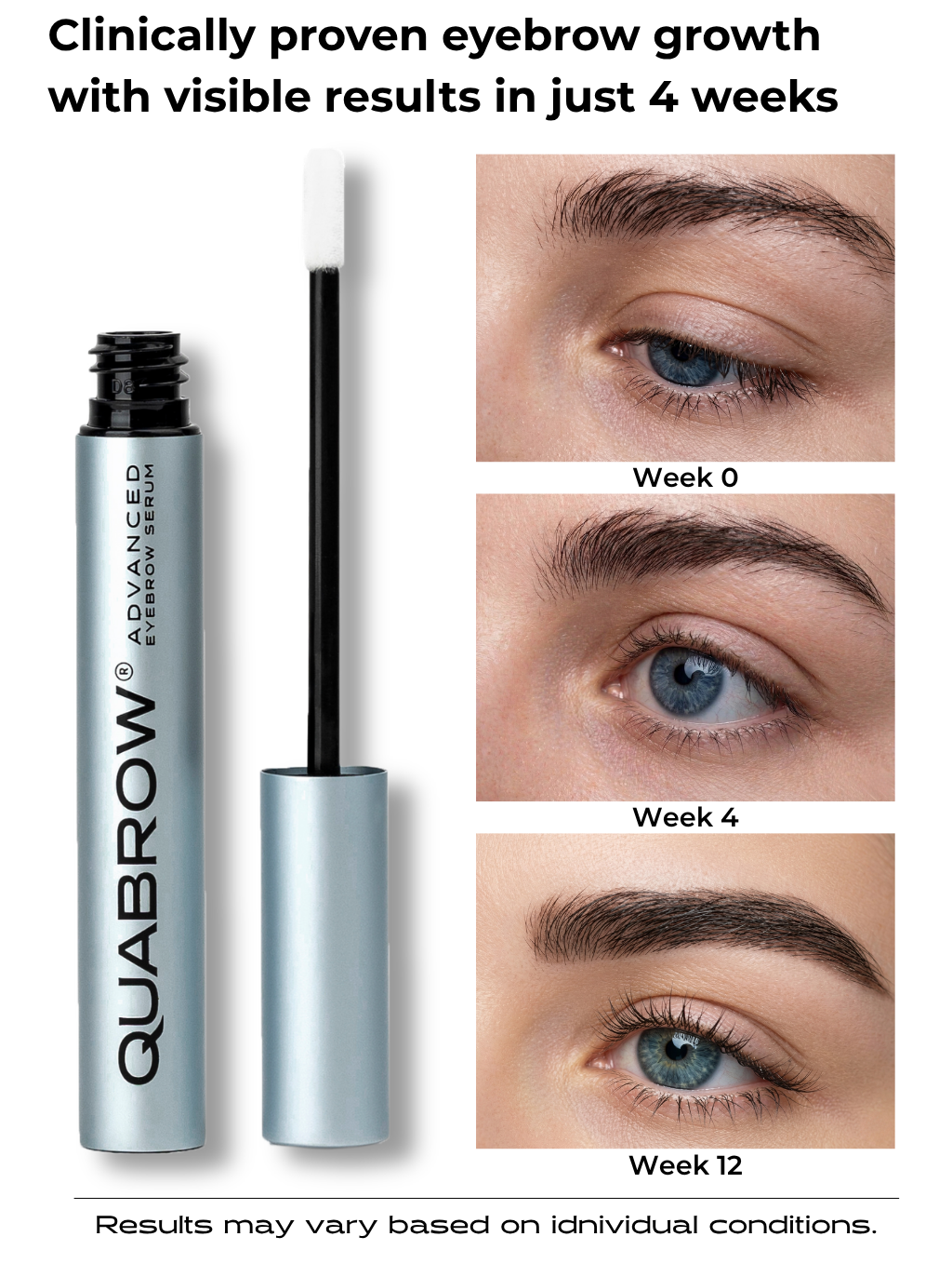 Ορός Ανάπτυξης Φρυδιών – Προηγμένος