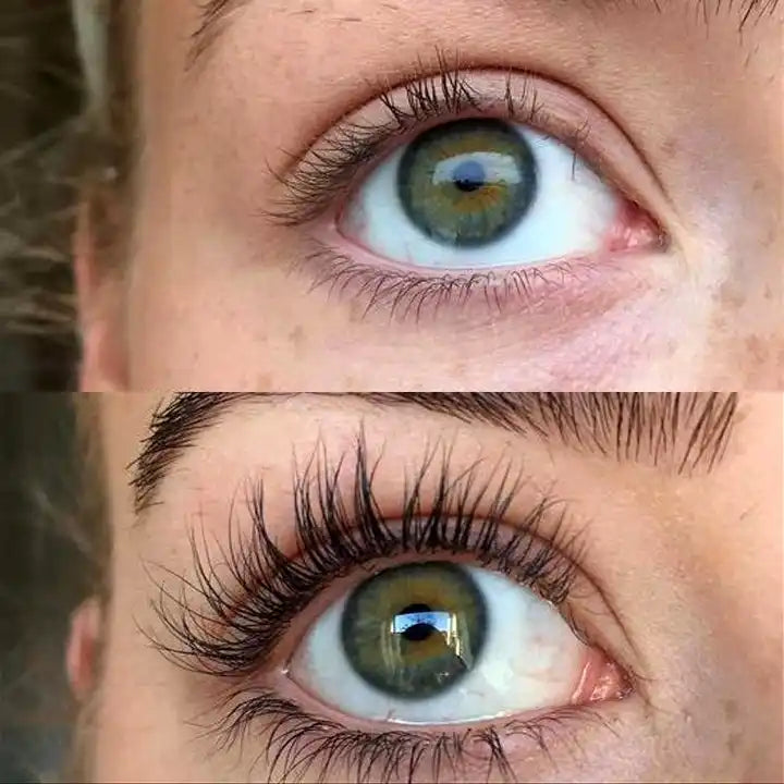 Eyelash transformation.