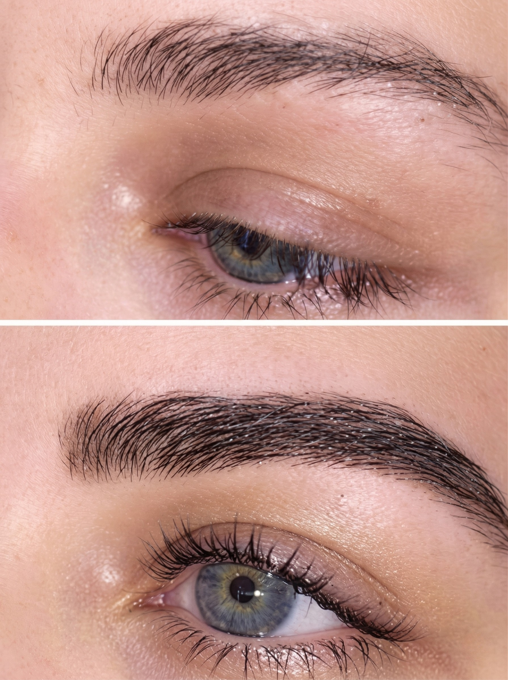 Ορός Ανάπτυξης Φρυδιών – Προηγμένος