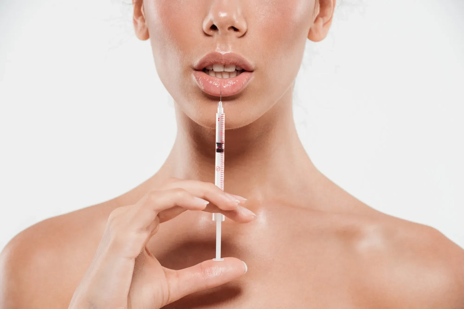  Lips After Hyaluronic Acid Fillers