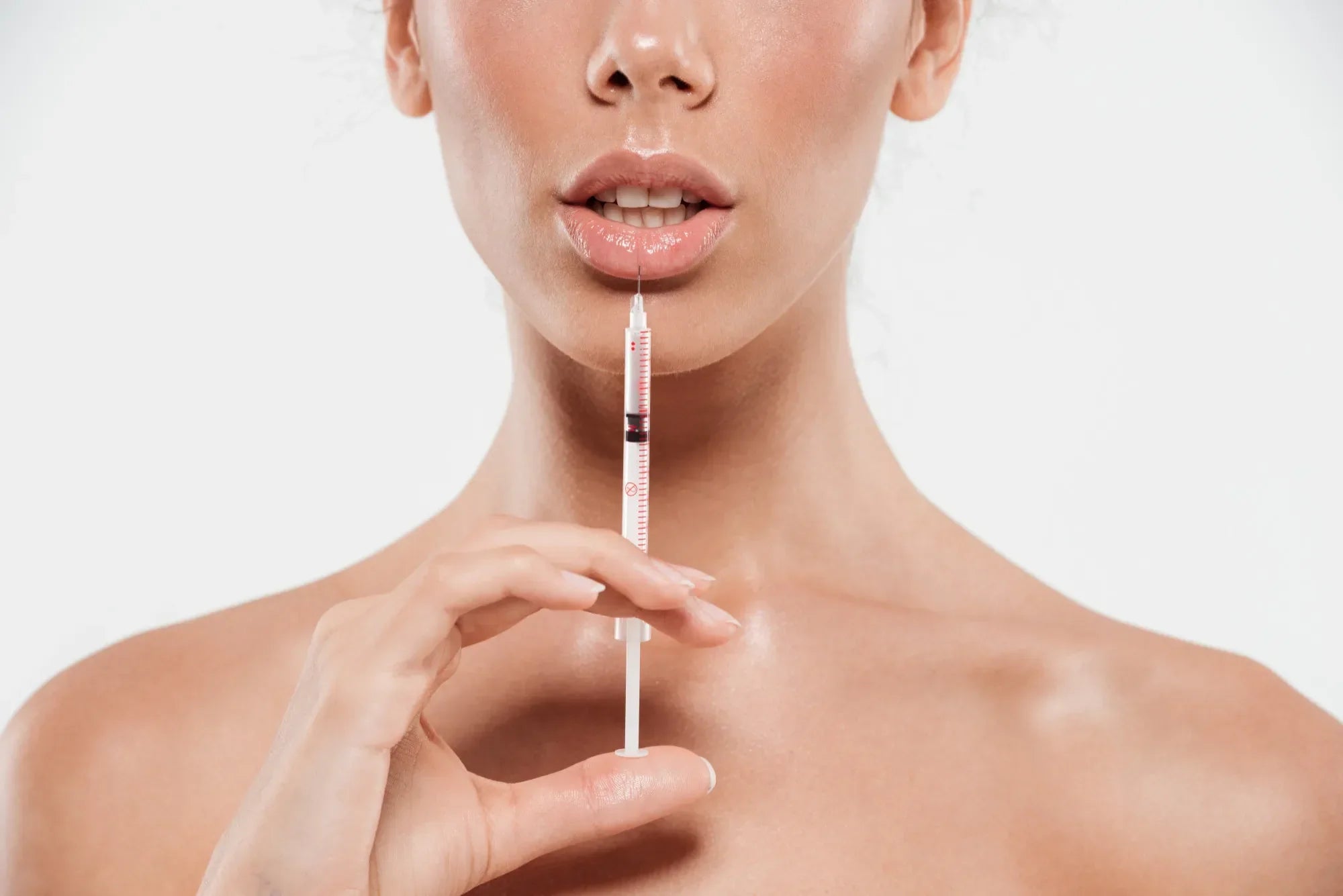  Lips After Hyaluronic Acid Fillers