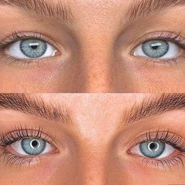 Significant eyelash enhancement on blue eyes with QUALASH serum